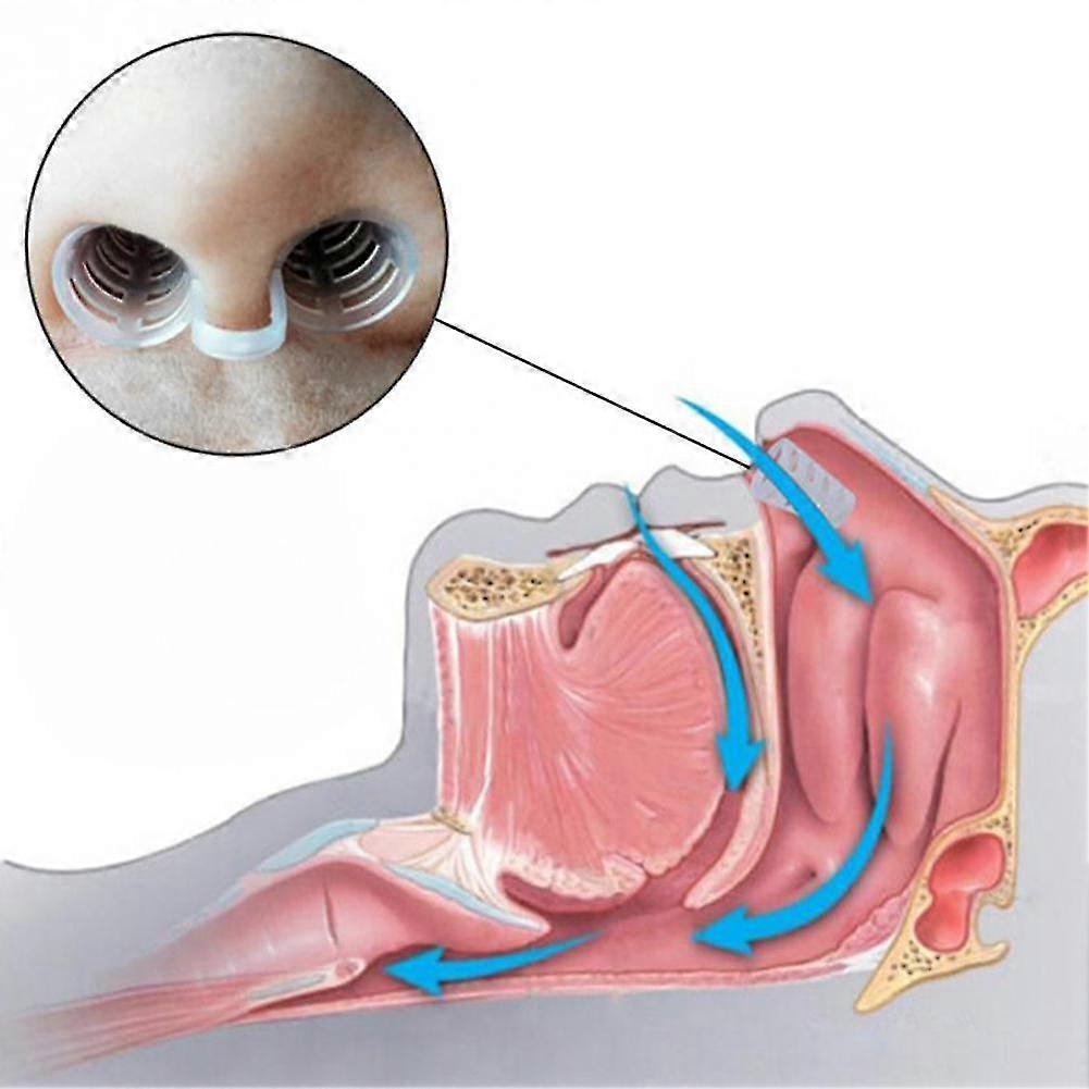 Tongue Stabilizer Mouthpiece for Snoring Reduction