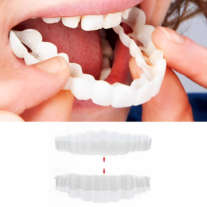 Complete Smile Veneer Kit for Top and Bottom Teeth