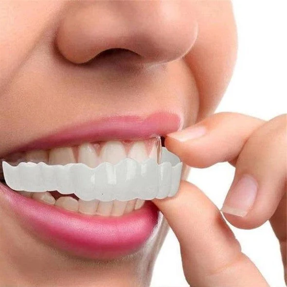 Complete Smile Veneer Kit for Top and Bottom Teeth