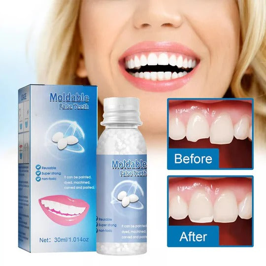 Temporary Moldable Teeth Repair Kit