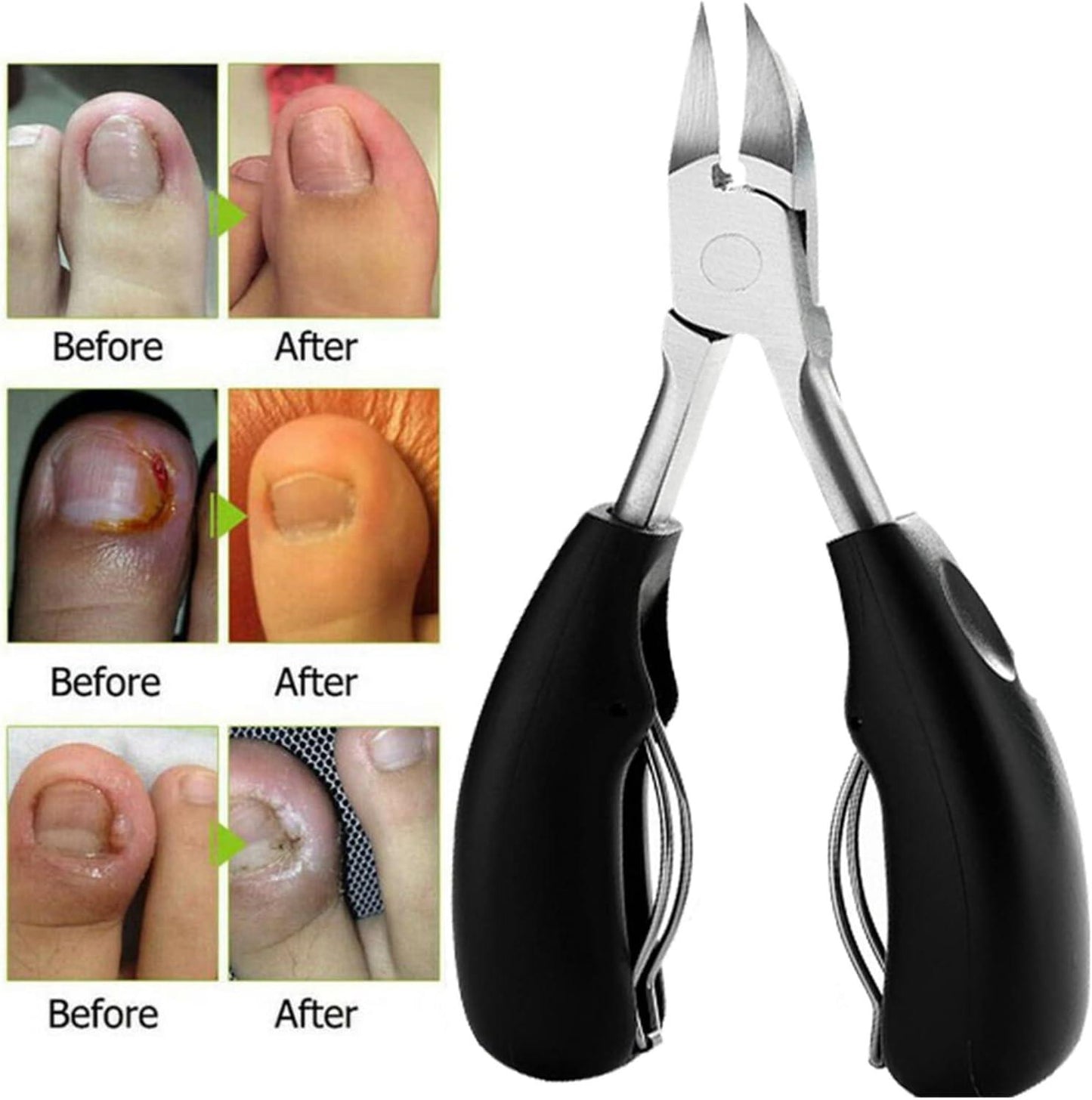 Heavy-Duty Toenail Clipper – Ideal for Seniors & Thick Toenails