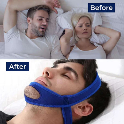 Full Head Chin Strap for Snoring Relief | Sleep Apnea Support - Comfortable - Night Use