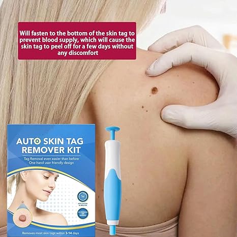 Skin Tag Removal Tool