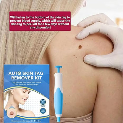 Skin Tag Removal Tool