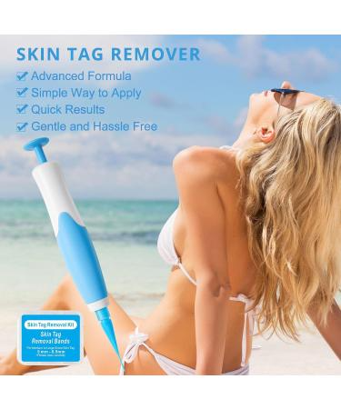 Skin Tag Remover Painless and Easy Home Treatment