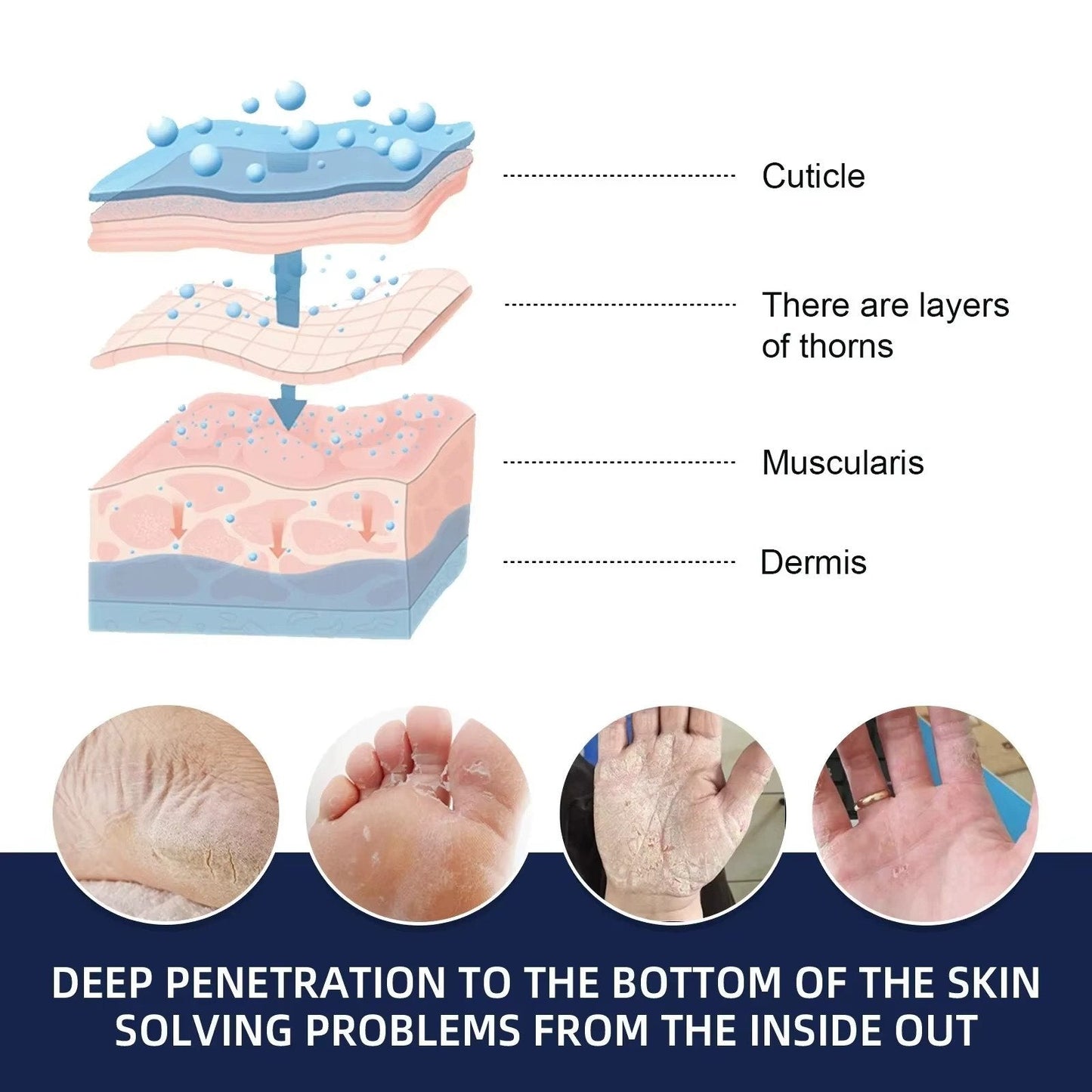 Cracked Foot Heel Treatment 3 Pack