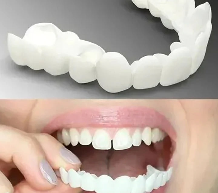 Snap On Dentures Instant Removable Dental Veneers