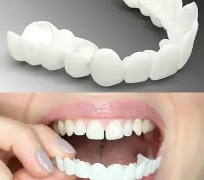 Snap On Dentures Instant Removable Dental Veneers