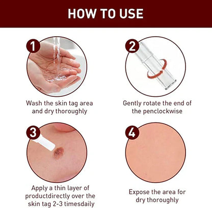 Tags & Moles Remover